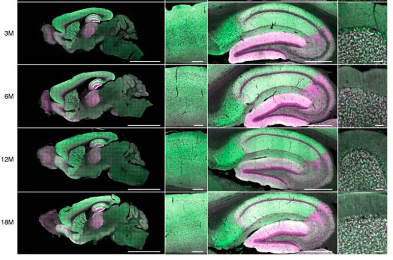 Changes in the entire brain (left) and hippocampus (middle) are evident in these images shot during the course of a mouse's life. Green shows the protein PSD95 and cyan is the protein SAP102. (KTH )