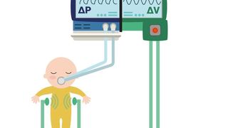 Schema des Thorax-Monitors im Betrieb: Die Atmung des Frühchens wird berührungslos gemessen. Diese Daten sollen zusammen mit den übrigen Messwerten des Beatmungsgeräts zu einer schonenden und effizienteren Beatmung führen (Fraunhofer IPA)