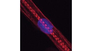 Humane Muskelzelle. Bei Menschen, die Statine nehmen, war u.a. die Produktion von Myosinen gestört. Diese Proteine sind im Bild rot angefärbt, der Zellkern blau. Die Querstreifen zeigen, dass die Zelle sich in eine reife Muskelfaser entwickelt. (Bild: Andreas Marg, MDC)