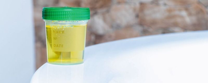 In fast allen Urinproben einer Untersuchung fanden Forscher den Stoff MnHexP mit teils hohen Werten. Es handelt sich um ein Abbauprodukt eines EU-weit verbotenen Weichmaers, der als verunreinigung in manchen Sonnencremes auftritt. (Symbolbild)(Bild: ©  Stefan Werner - stock.adobe.com)