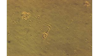 Eine NK-Zelle greift eine Tumor-Stammzelle an. (Archiv: Vogel Business Media)