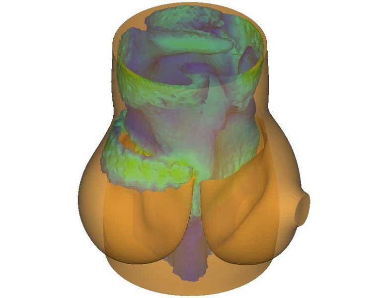 Dynamore hat eine aktuelle Version der FEM-Software LSDyna R7 lanciert. (Bild: Dynamore)