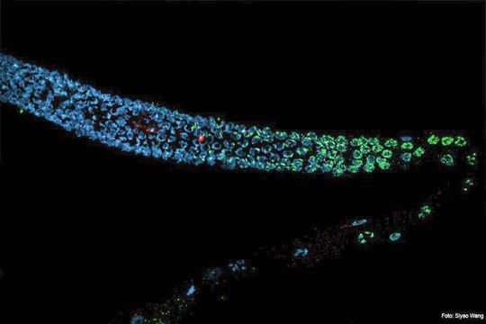 Schäden im väterlichen Genom des Fadenwurms Caenorhabditis elegans werden nicht repariert und stattdessen an die Nachkommen weitergegeben, während die weibliche Eizelle die Schäden repariert oder eingeht. Schäden im väterlichen Genom des Fadenwurms Caenorhabditis elegans werden nicht repariert und stattdessen an die Nachkommen weitergegeben, während die weibliche Eizelle die Schäden repariert oder eingeht.
