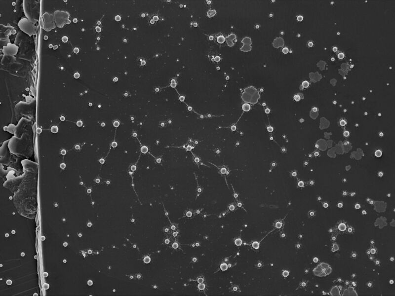Wolframpolyoxometallate als lebenserhaltende anorganische Strukturen. Einzelzellen von M. sedula nach Kultivierung mit wolframhaltigem W-POM.  (© Tetyana Milojevic)