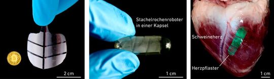 Der Stachelrochenroboter ist ca. 4 Zentimeter breit (links) und lässt sich aufrollen, sodass er in eine Kapsel passt, die Patienten zukünftig schlucken könnten (Mitte). Die neuartigen Muskeln können auch als Pflaster auf einem Herz angebracht werden (rechts). (Bild:  Bilder: Shi Z et al. Nature 2025)