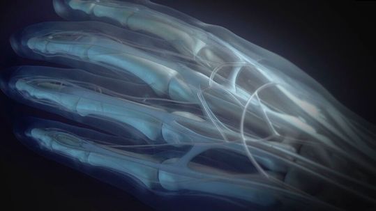 Anatomische Modelle, die mit dem neuen Stratasys Radiomatrix-Material gedruckt wurden, werden auf CT-Scans und Röntgenbildern radiologisch-realistisch dargestellt.(Bild:  Stratasys)