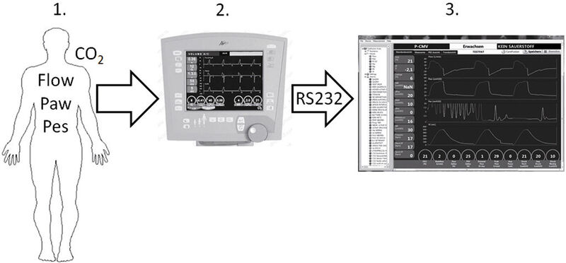Bild 1: Datenerfassung während einer Beatmungsstudie. Am Patienten (1) werden mit einem Beatmungsgerät (2) unterschiedliche Beatmungsparameter gemessen (Pes=Druck in der Speiseröhre, Paw=Beatmungsdruck). Über eine RS-232-Schnittstelle werden die Daten erfasst und auf dem PC weiterverarbeitet (3) (NI)