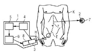 Verfahren und Vorrichtung zur Steuerung der Bewegung eines länglichen medizinischen Instruments innerhalb eines Körpers (Bild: Siemens Healthineers/DPMA)