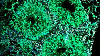 Menschliches Gehirnorganoid mit Ventrikeln, die aus neuralen Vorläuferzellen (grün) und neugeborenen Neuronen (grau) bestehen (MPI/Anthi Krontira)