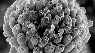 Die elektronenmikroskopische Aufnahme des Gießkannenschimmels (Aspergillus) zeigt deutlich, dass nach Behandlung mit dem körpereigenen Fungizid der Sporenträger des Pilzes zerstört ist. (Foto/Copyright: Kyaw Zaw Hein)