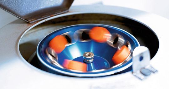 L'automatisation arrive aussi dans les laboratoires notamment grâce à l'intégration des minimoteurs Faulhaber dans les installations de diagnostic. L'automatisation arrive aussi dans les laboratoires notamment grâce à l'intégration des minimoteurs Faulhaber dans les installations de diagnostic.