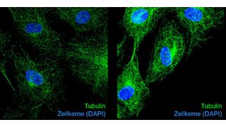 Immunfluoreszenzaufnahmen von Tubulin (grün) und Zellkernen (blau) in unbehandelten (links) und Glyoxal-behandelten Endothelzellen (rechts). Die Glykierung von Tubulin durch Glyoxal führt zu veränderter Mikrotubuli-Dynamik und Hemmung der Zellteilung. (Bild: Institut für Molekulare Zellbiologie / UKJ / Katrin Spengler)