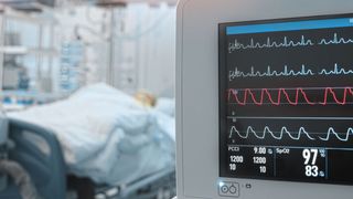 Insbesondere in Bereichen mit vielen „piependen“ Geräten wie Intensivstationen und Operationssälen, können kontextualisiert designte Alarmklänge die akustische Belastung erleichtern. (Bild: sudok1 - stock.adobe.com)