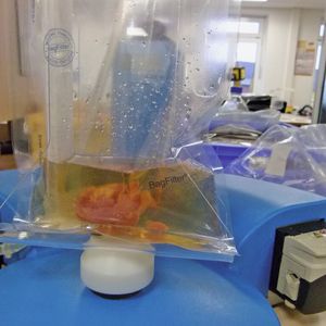 Abb. 2: Die eingereichten Fleisch- und Wurstwaren werden bei LADR unter anderem auf Salmonellen, die aerobe mesophile Keimzahl oder E. coli-Bakterien untersucht. Über ein Barcode-Etikett, das zudem Angaben für die anzuwendende Kontrollmethode umfasst, ist jede Probe genau nachverfolgbar.