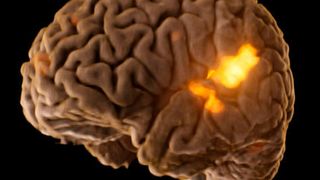 Dieses Bild, eine Fusion aus anatomischen und funktionellen MR-Aufnahmen, zeigt die Gehirnareale, die beim Hören von Musik aktiv sind. (Fraunhofer MEVIS)