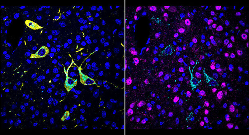The newly developed method, called Catch, shows how drugs hit their targets in the body. Cells targeted by a drug (pargyline, shown in cyan) can be identified by multiple rounds of immunolabeling (red showing neurons; yellow showing dopaminergic/noradrenergic neurons; blue showing cell nuclei). (Scripps Research)