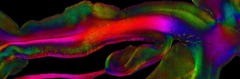 Der Hippocampus, ist eine der in besonders viele Funktionen involvierten Regionen des Gehirns. Hier ist seine Struktur sichtbar gemacht mit dem in Jülich und Düsseldorf entwickelten Verfahren PLI (Polarized Light Imaging). (Forschungszentrum Jülich / Markus Axer)
