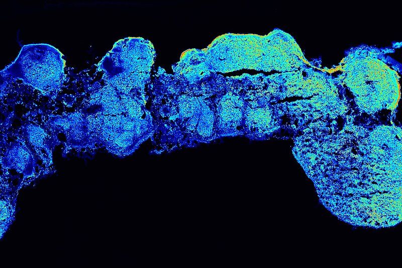 Gehirne aus der PetrischaleOrganoide des Gehirns erlauben Wissenschaftlern einen einzigartigen Blick auf das menschliche Gehirn. Die im Labor gezüchteten Zellgruppen organisieren sich selbst zu Zellstrukturen, die denen von Organen ähneln. Die Arbeitsgruppe von Jürgen Knoblich der Australian Academy of Science schaffte es mithilfe einer neuen Methode, Organoide mit verschiedenen kortikalen Bereichen und einer anterioren – posterioren Musterbildung nachzubilden. Das Besondere: Durch diese speziellen Eigenschaften soll das 3D-Modell das menschliche Gehirn besser darstellen, wodurch es sich vor allem zur Erforschung der Gehirnentwicklung und Hirnerkrankungen eignet.  Im Bild zu sehen ist ein Längsschnitt eines polarisierten kortikalen Assembloids, mit dem vorderen Bereich links und dem hinteren Bereich rechts. Die Probe ist mit NR2F1 gefärbt und mit der Rainbow Royal Intensitätsskala visualisiert.  Hier geht's zur Originalmeldung Wissenschaftsbild des Tages vom 19.9.2024  (Bild: Camilla Bosone)