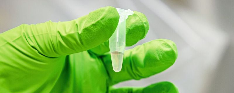 Abwasserprobe vor der Sequenzierung(Bild:  Felix Petermann, Max Delbrück Center)