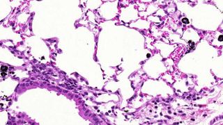 Lungengewebe der Maus mit Carbon-Black-Partikeln (Bild: Fraunhofer ITEM, in: Eur J Pharm Biopharm 75 (2010) 107-116) (Bild: Fraunhofer ITEM, in: Eur J Pharm Biopharm 75 2010)