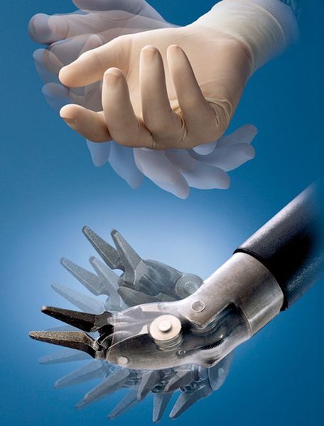 Bild 6: Nur für das da-Vinci-System steht mit Endowrist ein speziell für einen Manipulatoreinsatz angepasstes Instrument zur Verfügung. (Archiv: Vogel Business Media)