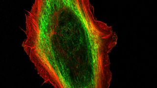 Immunfluoreszenzmikroskopie-Aufnahmen einer unveränderten Keratinozyte: Bei dieser Form der Lichtmikroskopie können zu untersuchende Strukturen mit hohem Kontrast dargestellt werden. Der dunkle Bereich in der Mitte ist der Zellkern, der von einem hellgrünen Ring von Keratinen umgeben wird. Bei den genveränderten Zellen würde der hellgrüne Bereich fehlen. Der äußere, rote Bereich besteht aus einem Netz des Strukturproteins Aktin. (Bild: Forschungszentrum Jülich)