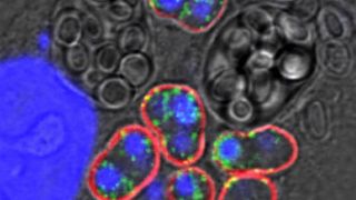 Die Immunofuoreszenzmikroskop-Aufnahme zeigt Mikrosporidien der Art Trachipleistophora hominis in kultivierten Nierenzellen; die Hüllmembran der Parasiten sind rot gefärbt, Mitosomen leuchten grün, die DNA der Zellkerne erscheint blau. (Alina V. Goldberg)