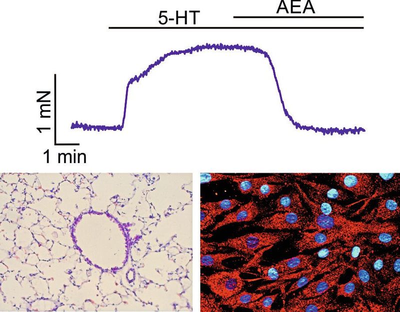 Oben die Kraftmessungen in den Bronchien. Nach der Gabe von Anandamid lässt die Spannung nach. Unten links ein histologischer Schnitt einer Mauslunge mit zentralem Bronchus und unten rechts menschliche bronchiale Muskelzellen mit roter Immunfärbung gegen FAAH, die Zellkerne sind blau gefärbt.