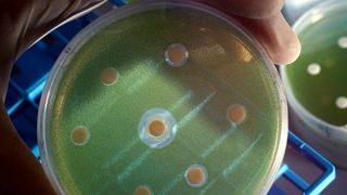 Agarplatte mit Grünalgen, auf die Bakterien (Mitte) bzw. Bakterienextrakte aufgebracht sind. Im Zentrum ist deutlich ein gehemmtes Algenwachstum als Halo erkennbar.  (Jan-Peter Kasper)