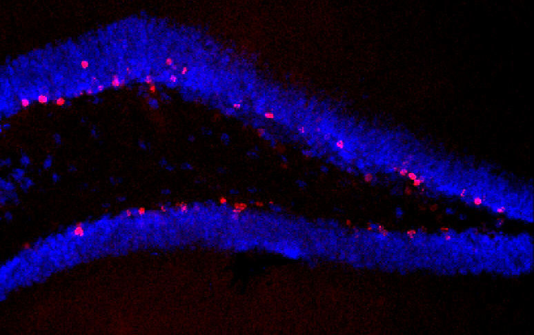 Der Hippocampus von unbehandelten Tieren, die trainiert haben: Zahlreiche Zellen bilden sich neu (rot markiert). (Bild: Susanne Wolf/MDC)