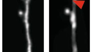 Ein Dornfortsatz (ca. 1 Mikrometer im Durchmesser) einer Großhirnnervenzelle einer lernenden Maus wird abgebaut. Zwei Bilder an zwei verschiedenen Tagen (roter Pfeil: fehlender Dornfortsatz). (Ausschnitt) (Bild: Hertie-Institut für klinische Hirnforschung (HIH))