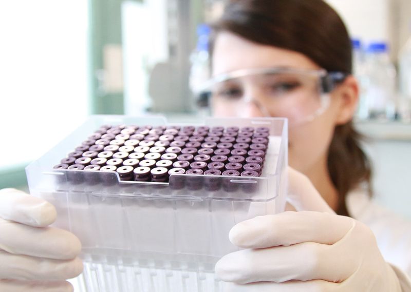 Numares hat mit der NMR einen Weg gefunden, bei der Diagnose einer drohenden Nierenabstoßung die risikoreiche Biopsie zu umgehen. Zu einem brauchbaren Ergebnis kommt man auch mit einer simplen Urinprobe. Bis 2016 will Numares ein marktreifes Produkt entwickeln. (Bild: Numares)