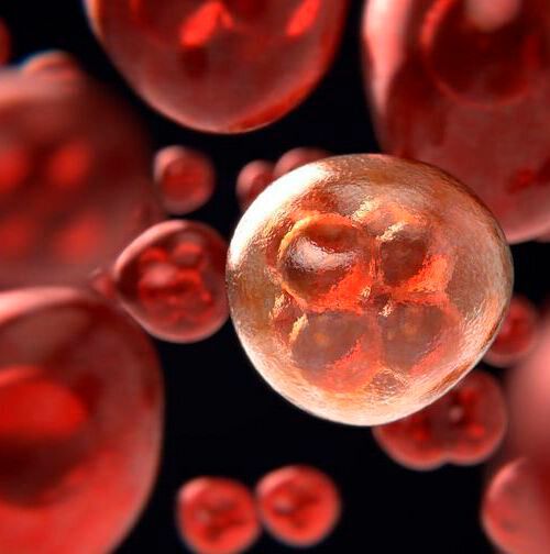 Myeloma is the second most common blood cancer, and t(4;14) myeloma comprises 15 to 20 per cent of MM cases. Myeloma is the second most common blood cancer, and t(4;14) myeloma comprises 15 to 20 per cent of MM cases.