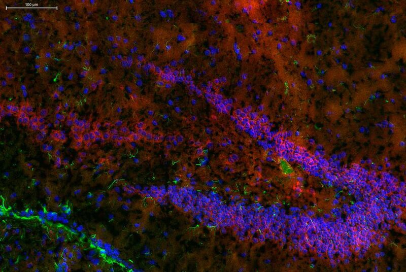 Ein Teil der Gehirnstruktur Hippocampus mit fluoreszierendem Endocannabinoid-System in Nervenzellen.  (© IBMM, Universität Bern)