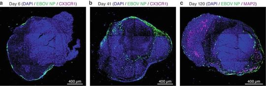 Ein Hirnorganoid, das mit dem Ebola-Virus infiziert ist, zu den Zeitpunkten 6, 41 und 120 Tage nach der Infektion. Die Forschenden haben das Hirnorganoid mit Fluoreszenzfarbstoffen gefärbt. Das Nukleoprotein des Ebola-Virus ist in grün sichtbar, verschiedene Gehirnzellen sind in magenta zu sehen, die Zellkerne aller Zellen sind blau gefärbt.   (Bild:  ©Widerspick L. et al. 2026)