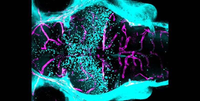 Blut-Hirn-Schranke passieren  Bei ihrer Arbeit mit Mäusen und Zebrafischen haben Forscher der Harvard Medical School ein Gen identifiziert, das in Neuronen exprimiert wird und ein Signal erzeugt, welches für die Entwicklung und Aufrechterhaltung der Blut-Hirn-Schranke erforderlich ist. Ist dieses Gen mutiert, macht es bestimmte Regionen der Blut-Hirn-Schranke durchlässiger. Diese neuen Erkenntnisse könnten dabei helfen, die Blut-Hirn-Schranke gezielt für medikamentöse Therapien zu beeinflussen oder die Entstehung neurodegenerativer Krankheiten besser zu verstehen. Bildbeschreibung: Als die Forscher einen fluoreszierenden Farbstoff (blau) in das Kreislaufsystem eines Zebrafisches mit einer Spock1-Mutation injizierten, trat der Farbstoff aus den Blutgefäßen (rosa) im Vorder- und Mittelhirn (l.) aus, blieb aber im Hinterhirn (r.) relativ begrenzt, was auf eine Blut-Hirn-Schranke hindeutet, die in einigen Bereichen durchlässig war, in anderen jedoch nicht.  Hier gehts zur Originalmeldung Wissenschaftsbild des Tages vom 17.8.2023  (Natasha O'Brown)