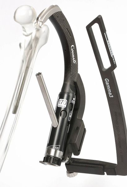 Moll Engineering stellt Bohrschablonen aus CFK für die Traumachirurgie her. (Moll Engineering)