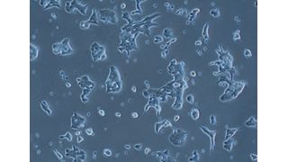 Insulin-producing cells of the mouse in cell culture.  (Source: Dr. Tin Manh Ho)