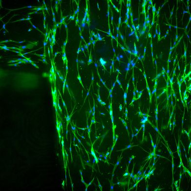 In the PhysioINK project, Fraunhofer researchers are developing bio-printing inks from the most common tissue proteins. Under the microscope, the living tissue cells (fibroblasts) are visible in the printed lattice structure: blue represents the cell nucleus, and green represents the cytoskeleton. (Source: Tobias Weigel/Fraunhofer ISC)