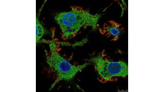 Mikroskopische Aufnahme von Zellen des angeborenen Immunsystem mit Archaeen. (Tim Vierbuchen, FZB)