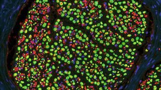 Querschnitt durch einen peripheren Nerv der Maus. Einzelne Axone wurden in rot markiert. Schwann Zellen, die die Axone mit einer fettreichen Isolationsschicht ringförmig ummanteln, sind in grün dargestellt. Die Zellkerne aller Zellen im Nerv sind blau markiert. (Bild: Institut für Physiologische Chemie, Universität Ulm)