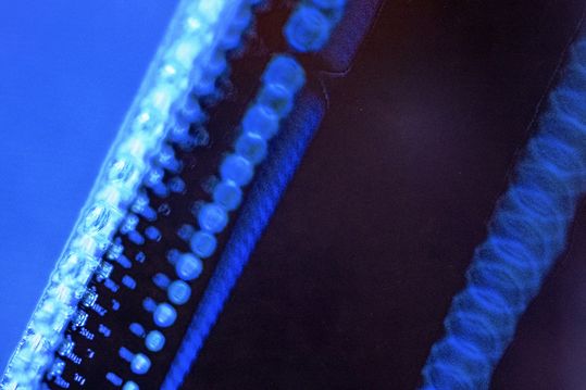 Mikroskopbild 3D-gedruckter Mikrolinsen an der Kante eines photonischen Mikrochips.(Bild:  Ansgar Puden)