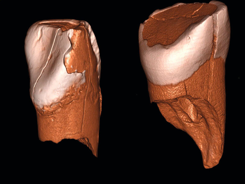 Dreidimensionale digitale Modelle des unteren Schneidezahns aus Riparo Bombrini (links) und des oberen Schneidezahns aus der Grotta di Fumane (rechts). Bei beiden Zähnen handelt es sich um Milchzähne. (Bild: Daniele Panetta)