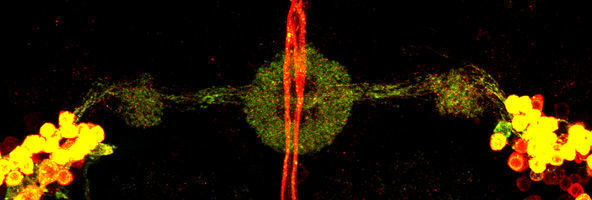 Anfärbung von Amyloid-Precursor-Protein-Fragmenten (rot und grün) im visuellen Arbeitsgedächtnis des Fliegengehirns (Ring im Zentrum). Unprozessiertes Gesamtprotein erscheint gelb. (AG Strauss, Johannes Gutenberg Universität)