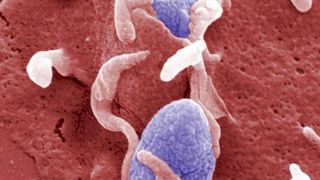 Yersinien (in blau) dringen in Hep2-Zellen ein.  (Bild: Manfred Rohde / HZI)