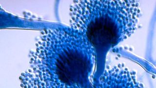 Bild des Schimmelpilzes Aspergillus fumigatus in Vergrößerung.  (Alunos Online / https://microbewiki.kenyon.edu/index.php/MicrobeWiki)