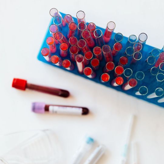 A new drug offers world first treatment for Lipoprotein(a), a largely genetic form of cholesterol that increases the risk of heart attack/stroke. A new drug offers world first treatment for Lipoprotein(a), a largely genetic form of cholesterol that increases the risk of heart attack/stroke.