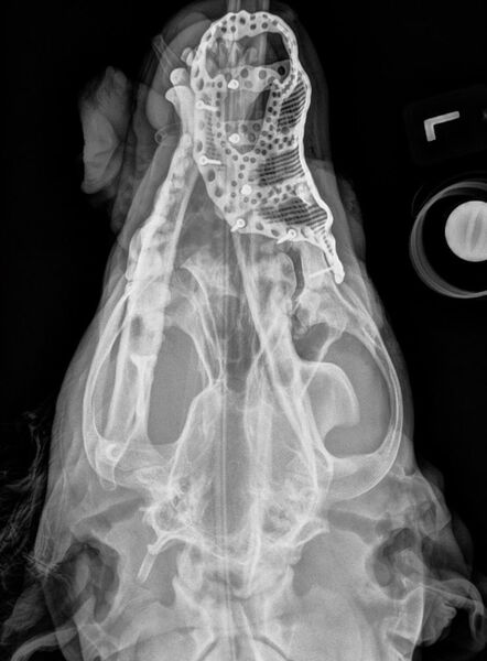Eine Röntgenaufnahme nach der Operation: So sieht das Implantat von oben aus. (Renishaw)