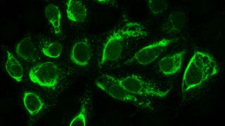 Mit dem Zika-Virus infizierte Zellen fluoreszieren, wenn sich im Blut des Patienten Antikörper gegen das Virus befinden. (Bild: Euroimmun)