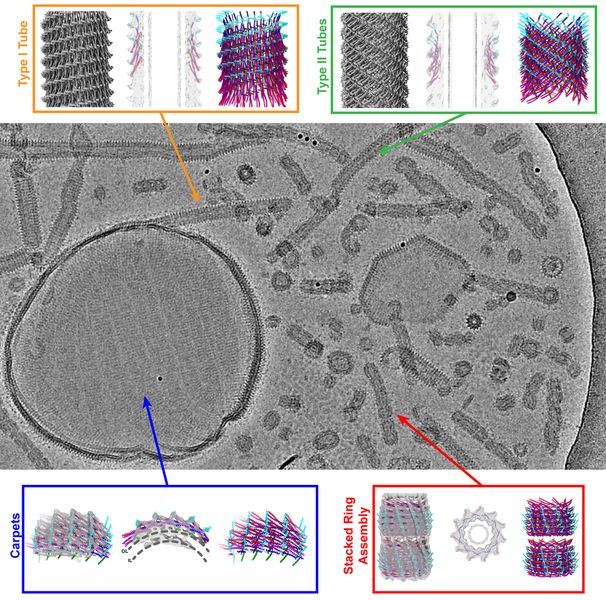 Einblicke ins Reparatursystem der Zelle Die Zellmembran hat zahlreiche wichtige Aufgaben. Trotz ihrer zentralen Rolle ist sie auch sehr empfindlich und auf Proteine wie Vipp1 angewiesen, die Membranstrukturen schützen und bei Bedarf reparieren. Wie genau der Mechanismus funktioniert, ist noch nicht vollständig verstanden. Dank der hochmodernen Kryo-Elektronenmikroskope am Jülicher Ernst-Ruska-Centrum haben Forscher nun jedoch neue Einblicke in die Interaktion zwischen Vipp1 und der Zellmembran gewonnen. Sie entdeckten, dass das Protein teppichartige Strukturen auf der Zellmembran ausbildet und sie damit stabilisiert. Darüber hinaus fanden die Wissenschaftler Ringkomplexe und Röhren aus Vipp1 gefüllt mit Membran, die möglicherweise beschädigte Membranbereiche „abschnüren“ oder aber auch zwei getrennte Membranen miteinander verbinden können. Das Bild zeigt eine Kyro-EM-Aufnahme verschiedener Vipp1-Strukturen: teppichartige Strukturen („Carpets“), Ringkomplexe („Stacked Ring Assembly“) und Röhren („Type I / Type II Tubes“).     Hier gehts zur Originalmeldung Wissenschaftsbild des Tages vom 15.10.2024  (Bild: Forschungszentrum Jülich / Bendikt Junglas, Carsten Sachse)